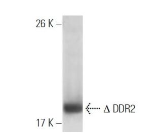 DDR2 Antibody (3B11E4) - Western Blotting - Image 137452The Double Nickase Plasmid features a U6 promoter for sgRNA expression, a 20 nt targeting sequence, and a gRNA scaffold to guide Cas9n. It includes a CBh promoter for Cas9n (D10A) and puromycin resistance, GFP for transfection verification, and nuclear localization signals (NLS). The 2A peptide allows co-expression of Cas9n and Puro from a single promoter, enabling precise genome editing with reduced off-target effects.