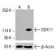 DDX11 항체 (C-10): sc-515166. 처리되지 않은 (A) 및 화학적으로 처리된 (B) HeLa 세포 전체 용해물에서 DDX11 발현의 웨스턴 블롯 분석. β-액틴 (C4): sc-47778을 로딩 대조군으로 사용. 사용된 검출 시약: m-IgG Fc BP-HRP: sc-525409. DDX11 Antibody (C-10) - Western Blotting - Image 415878