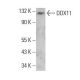 DDX11 Antibody (F-10) - Western Blotting - Image 384694