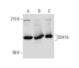 DDX16 Antibody (24) - Western Blotting - Image 134791 