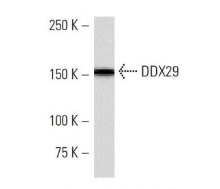 DDX29 Antibody (2269C1) - Western Blotting - Image 16619 