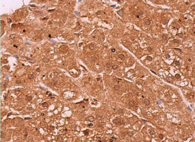 DDX3 Antibody (C-4) | SCBT - Santa Cruz Biotechnology