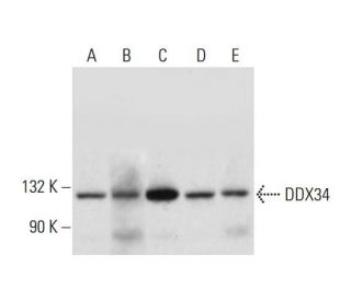 DDX34 Antibody (E-3) - Western Blotting - Image 325223 