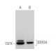 DDX34 Antibody (E-3) - Western Blotting - Image 369926 