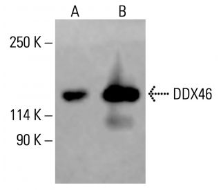 DDX46 Antibody (B-6) - Western Blotting - Image 415578