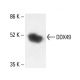 DDX49 Antibody (C-11) - Western Blotting - Image 411931