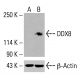 Anticorpo EDD (B-11): sc-515494. Análise por Western blot da expressão de EDD em lisados celulares completos de células HeLa não tratadas (A), células HeLa tratadas quimicamente (B) e células HCT-116 (C). β-Actina (C4): sc-47778 utilizado como controlo de carregamento. Reagente de deteção utilizado: m-IgG Fc BP-HRP: sc-525409. DDX8 Antibody (F-1) - Western Blotting - Image 416022