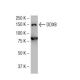DDX8 Antibody (F-19) - Western Blotting - Image 34385