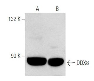 DDX8 Antibody (F-19) - Western Blotting - Image 54800 