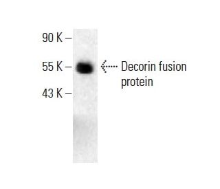Decorin Antibody (9XX) - Western Blotting - Image 398959 