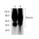 western blotting image from recommended Decorin (9XX) monoclonal antibody replacement. Image 380953