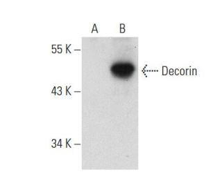 Decorin Antibody (9XX) - Western Blotting - Image 55513 