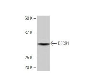 DECR1 Antibody (30-P) - Western Blotting - Image 53856