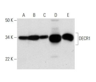 DECR1 Antibody (G-10) - Western Blotting - Image 295951 