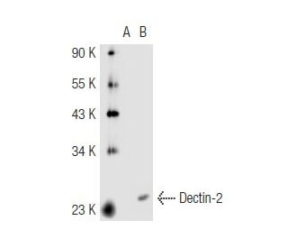 Dectin-2 Antibody (Z-17) - Western Blotting - Image 44894Each CRISPR/Cas9 Knockout (KO) Plasmid product consists of a pool of 3 plasmids designed to ensure identification and cleavage of a specific gene for maximum knockout efficiency. Each plasmid encodes a unique 20 nt sequence derived from the GeCKO (v2) library.