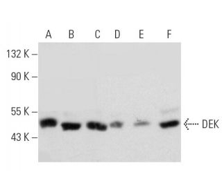 DEK Antibody (2) - Western Blotting - Image 389112 