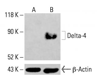 Delta-4 Antibody (G-12) - Western Blotting - Image 414317SAM Transcription Activation: SAM system utilizing dCas9-VP64, MS2-P65-HSF1, and sgRNA for precise gene transcription activation.
