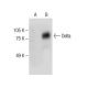 Delta Antibody (E-5) - Western Blotting - Image 284996