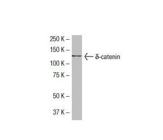 &delta;-catenin Antibody (40.1) - Western Blotting - Image 33443 