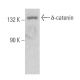δ-catenin Antibody (40.1) - Western Blotting - Image 368188