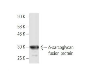 &delta;-sarcoglycan Antibody (3G10) - Western Blotting - Image 348839