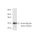 δ-sarcoglycan Antibody (3G10) - Western Blotting - Image 348839