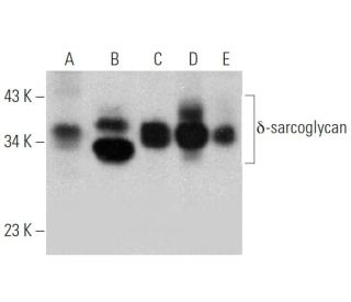 western blotting image from recommended &delta;-sarcoglycan (B-5) monoclonal antibody replacement. Image 363247