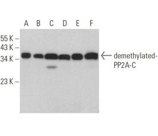demethylated-PP2A-C Antibody (4B7) - Western Blotting - Image 359157 