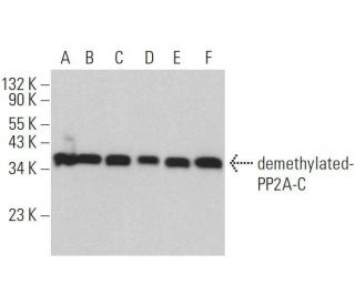demethylated-PP2A-C Antibody (4i57) - Western Blotting - Image 359163 