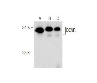 DENR Antibody (22) - Western Blotting - Image 164280 