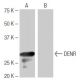 DENR Antibody (NQ-B8) - Western Blotting - Image 64909 