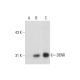DENR Antibody (NQ-B8) - Western Blotting - Image 127573 