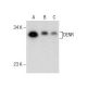 DENR Antibody (NQ-B8) - Western Blotting - Image 164279