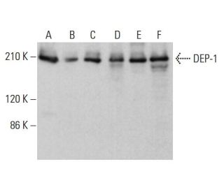 DEP-1 Antibody (B-2) - Western Blotting - Image 382324 