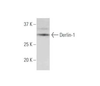 Derlin-1 Antibody (1B9) - Western Blotting - Image 347624
