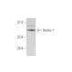 Derlin-1 Antibody (1B9) - Western Blotting - Image 347624
