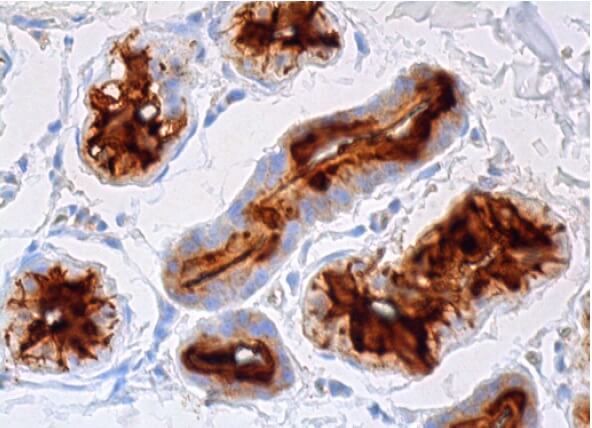 Dermcidin’s Mechanism of Action: A Novel Approach to Antiviral Therapy