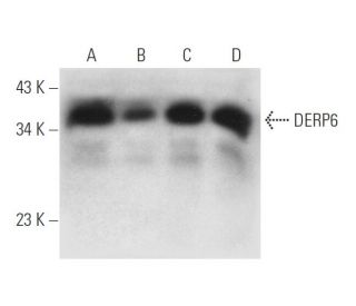 DERP6 Antibody (E-4) - Western Blotting - Image 314169 
