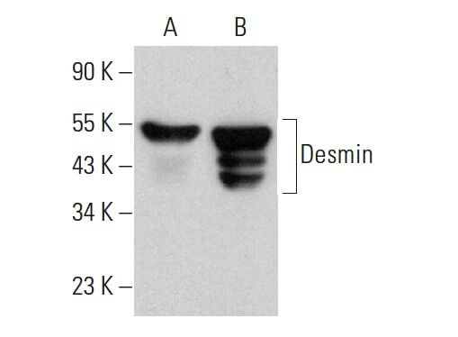 Desmin Antibody (B-7) | SCBT - Santa Cruz Biotechnology