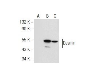 western blotting image from recommended Desmin (RD301) monoclonal antibody replacement. Image 53166