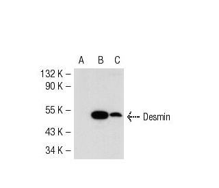 Desmin Antibody (D33) - Western Blotting - Image 53160 