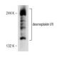 desmoplakin I/II Antibody (B-1) - Western Blotting - Image 146517