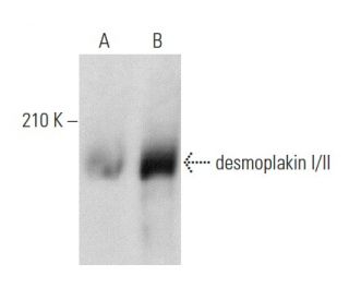 desmoplakin I/II Antibody (B-1) - Western Blotting - Image 356988 
