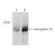 desmoplakin I/II Antibody (B-1) - Western Blotting - Image 356988 