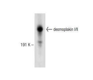 desmoplakin I/II Antibody (G-2) - Western Blotting - Image 147967 