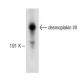 desmoplakin I/II Antibody (G-2) - Western Blotting - Image 147967 