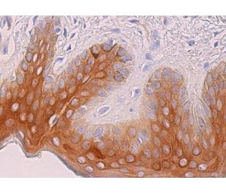 immunohistochemistry image from recommended desmoplakin I/II (A-1) monoclonal antibody replacement. Image 369147
