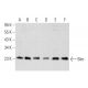 Dexamethasone: sc-29059. Western blot analysis of Bim expression in A-431 (A), Jurkat (B), Hep G2 (C), Dexamethasone treat 