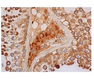 DFNA5 Antibody (G-9) - Immunohistochemistry - Image 344255 