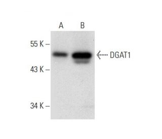 DGAT1 Antibody (G-6) - Western Blotting - Image 303823 
